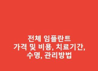 전체 임플란트 가격 및 비용, 치료기간, 수명, 관리방법 총정리 전체-임플란트-가격-및-비용-치료기간-수명-관리방법-1